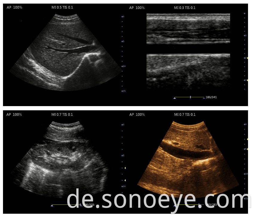 ultrasound machine laptop for Clinic